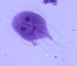 How Protozoa Cause Disease - Herpes & Coldsores Support Network