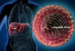 Hepatitis Pictures - Herpes & Coldsores Support Network