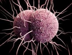 Gonorrhoea Information - Herpes & Coldsores Support Network