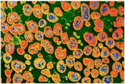 Gonorrhoea Pictures - Herpes & Coldsores Support Network