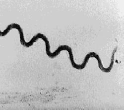 Syphilis Pictures - Herpes & Coldsores Support Network