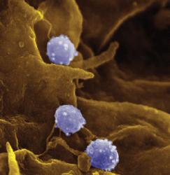 Chlamydia Information - Herpes & Coldsores Support Network