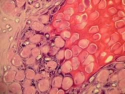 Molluscum Information - Herpes & Coldsores Support Network
