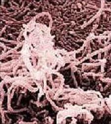 Chancroid Information - Herpes & Coldsores Support Network