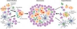Granuloma Pictures - Herpes & Coldsores Support Network
