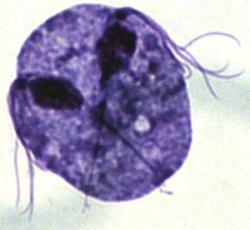 Trichomoniasis Information - Herpes & Coldsores Support Network