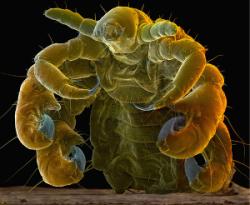 Pubic Lice Pictures - Herpes & Coldsores Support Network